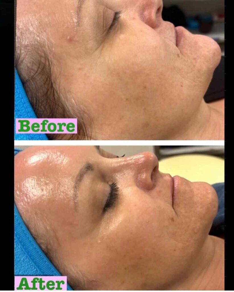 Claire Brokloff Before and Afters