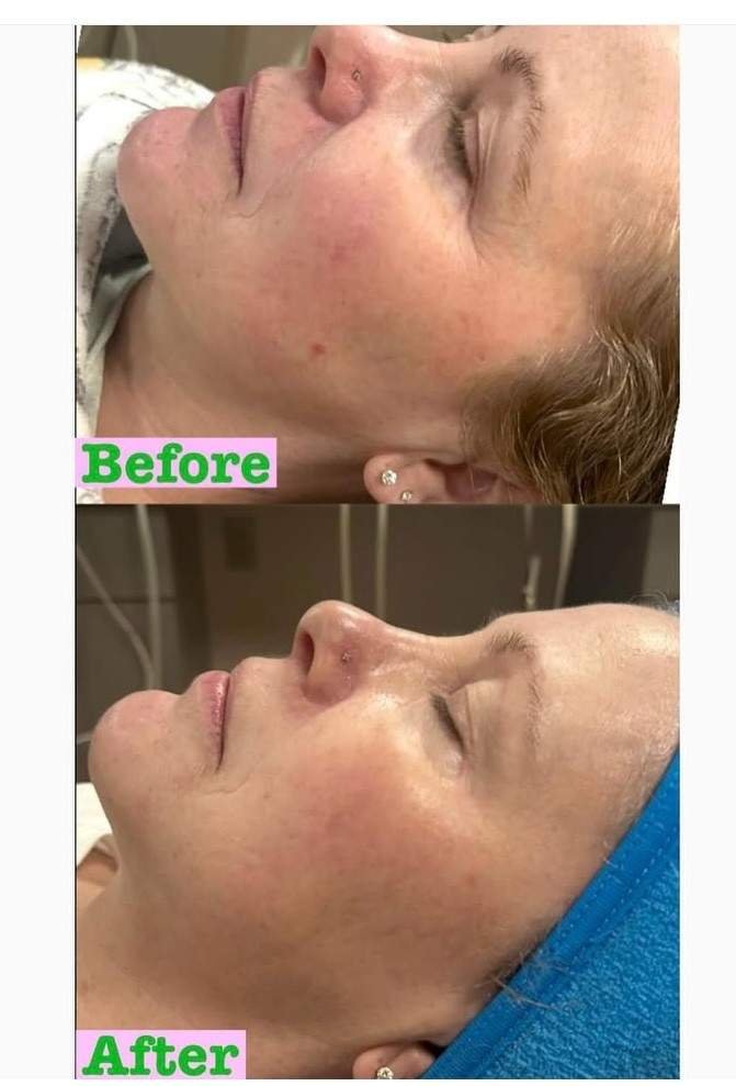 Claire Brokloff Before and Afters